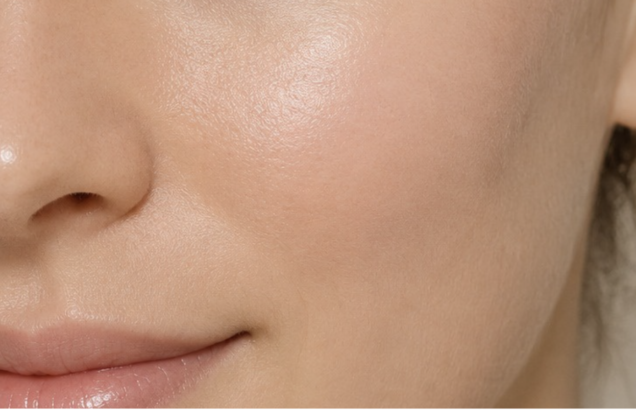 Skin after Hale Derma use